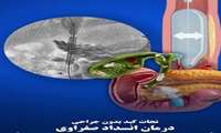  تیم آنژیوگرافی مرکز، مسیر حیات را به بیمار بازگرداند